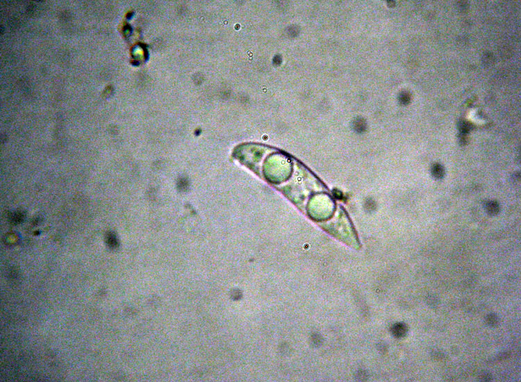 Forse non � Hymenoscyphus fructigenus ....